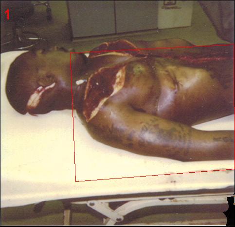 2pac dead body. images tupac shakur death pictures 2pac dead body picture. 2pac+dead